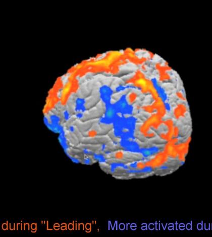 See what happens to your Brain when you Dance
