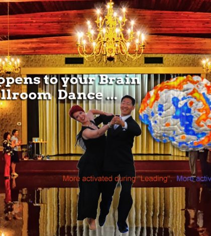 Your Brain When Dancing – MRI & Alzheimer’s Research